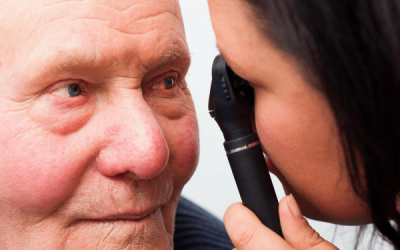 Cataracts and Vision Loss in Older Adults